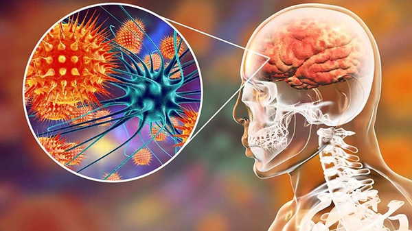 uzmanindan uyari menenjit sadece cocuk hastaligi degil gencler ve yaslilar da risk grubunda zjSIXMjg